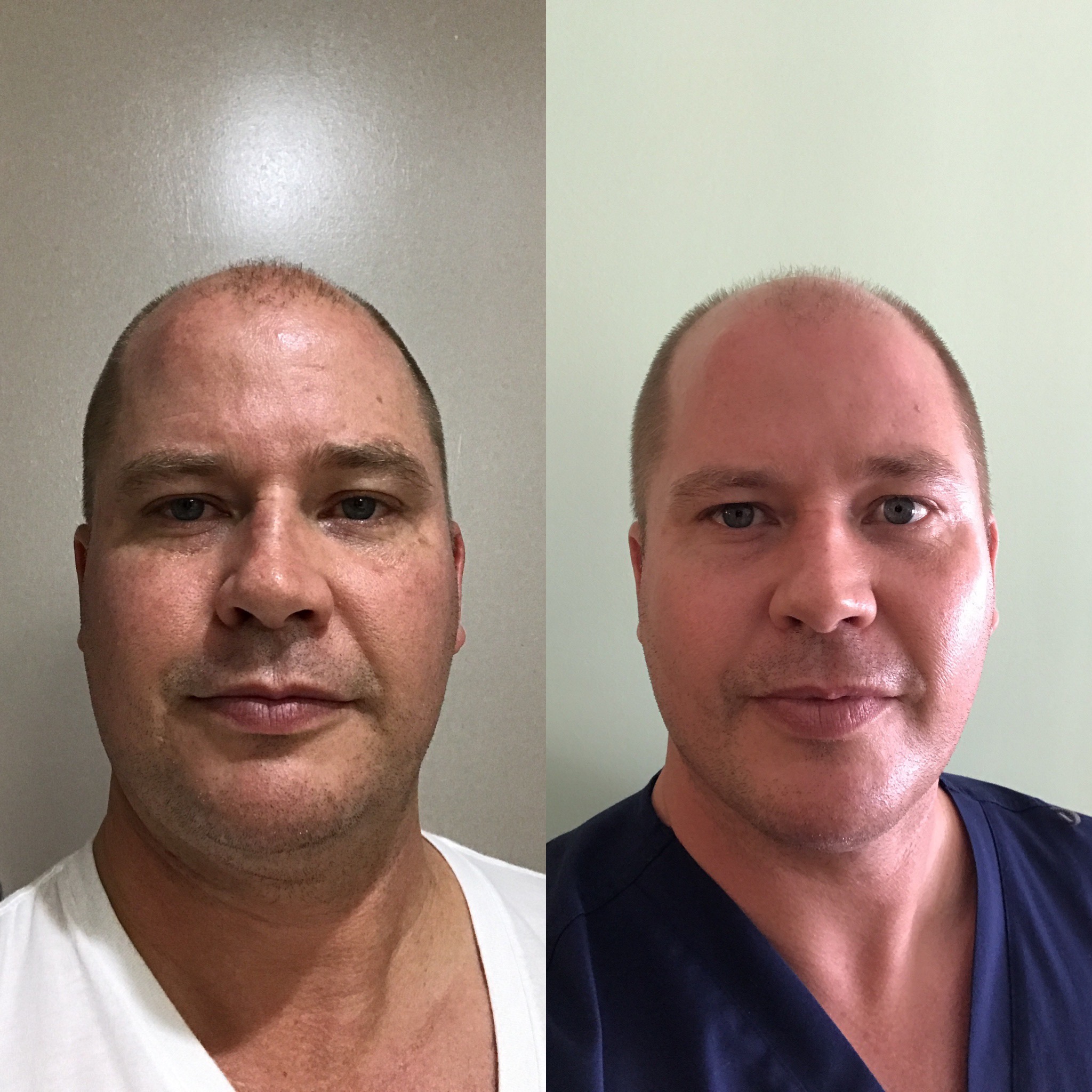 Regenerative Cell Therapy Near Me