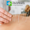 Injections For Pain at Pure Acupuncture